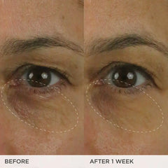 The Brightening Eye Cream